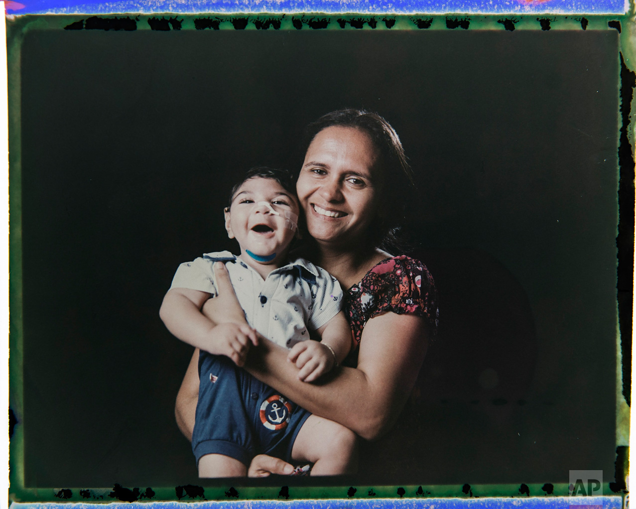  In this Sept. 29, 2016 photo made from a negative recovered from instant film, Rozilene Ferreira poses with her one-year-old son, Arthur Conceicao, who was born with microcephaly, one of many serious medical problems that can be caused by congenital
