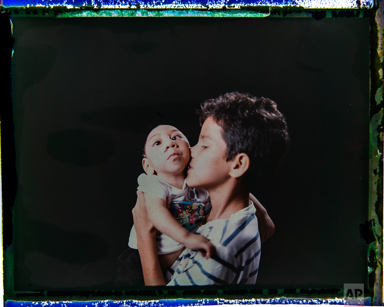  In this Sept. 27, 2016 photo made from a negative recovered from instant film, Elisson Campos poses with his one-year-old brother, Jose Wesley Campos, who was born with microcephaly, one of many serious medical problems that can be caused by congeni