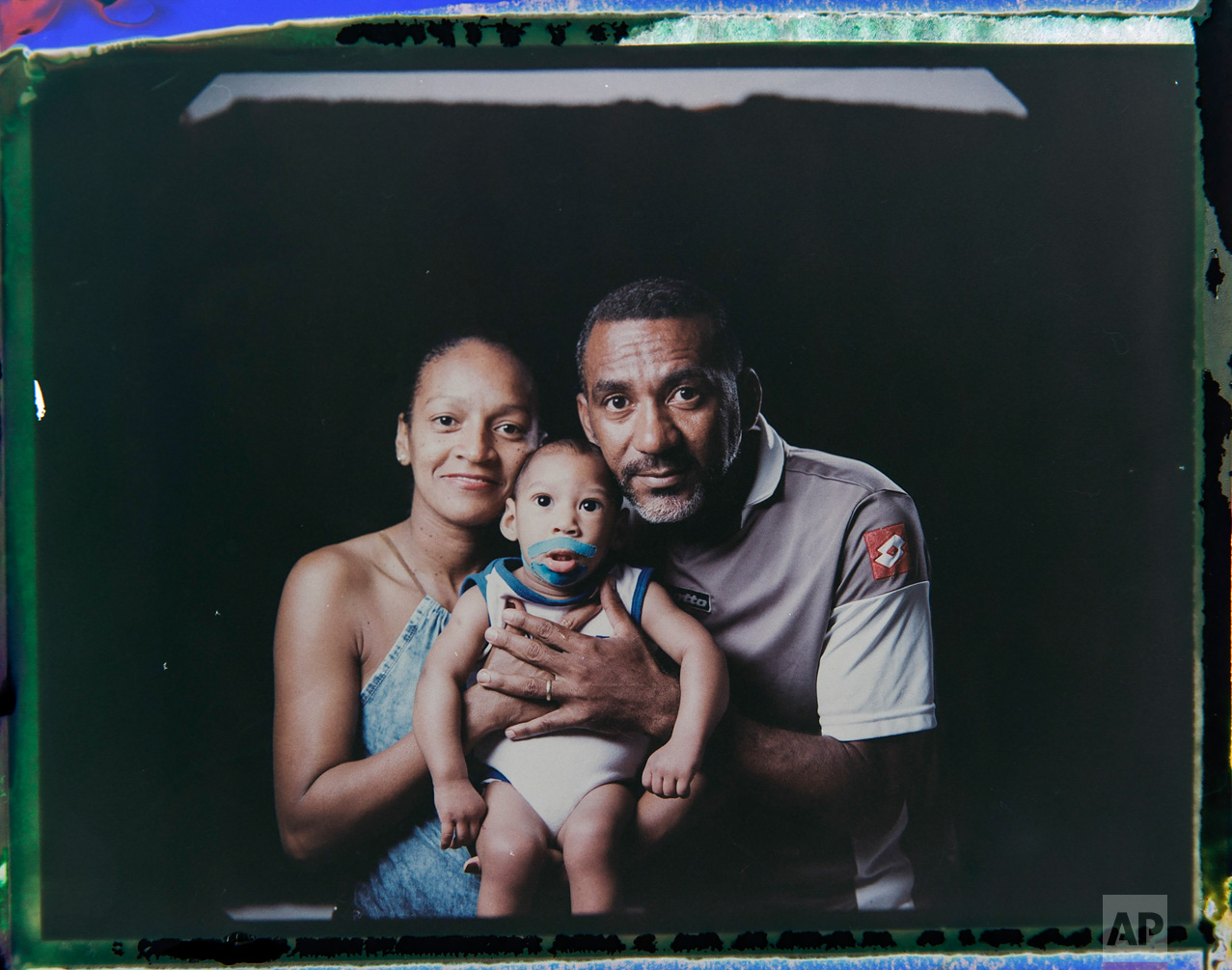  In this Sept. 29, 2016 photo made from a negative recovered from instant film, Diana Felix and Carlos Alberto Dias, pose with their son, Ezequiel, who was born with microcephaly, one of many serious medical problems that can be caused by congenital 