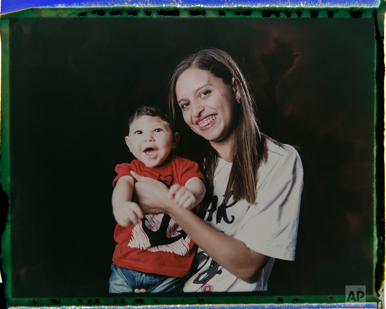  In this Sept. 29, 2016 photo made from a negative recovered from instant film, Daniele Ferreira dos Santos holds her son Juan Pedro, who was born with microcephaly, one of many serious medical problems that can be caused by congenital Zika syndrome,