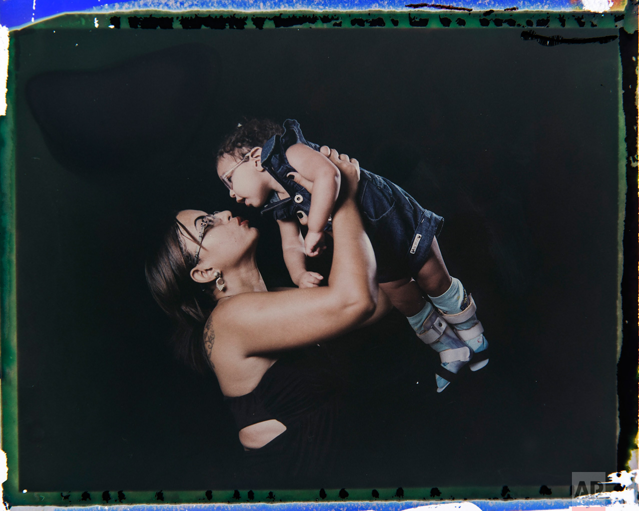  In this Sept. 29, 2016 photo made from a negative recovered from instant film, Rosana Alves holds her daughter Luana, who was born with microcephaly, one of many serious medical problems that can be caused by congenital Zika syndrome, as they pose f