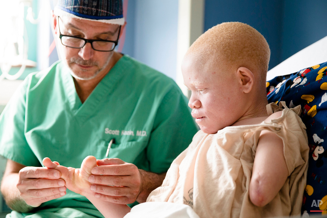  Dr. Scott H. Kozin examines 13-year-old Emmanuel Rutema, of Tanzania, who has the hereditary condition of albinism, before his surgery at the Shriners Hospital for Children in Philadelphia on Tuesday, June 30, 2015. People with the genetic condition