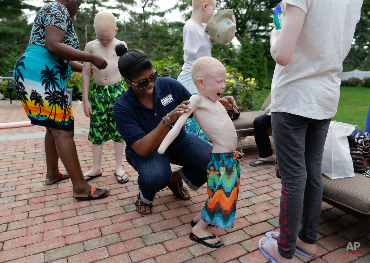  Monica Watson, center, applies sunscreen to Baraka Lusambo, of Tanzania, before he and four other children with the hereditary condition of albinism enter a swimming pool for the first time in their lives during a visit to a home in Oyster Bay, N.Y.