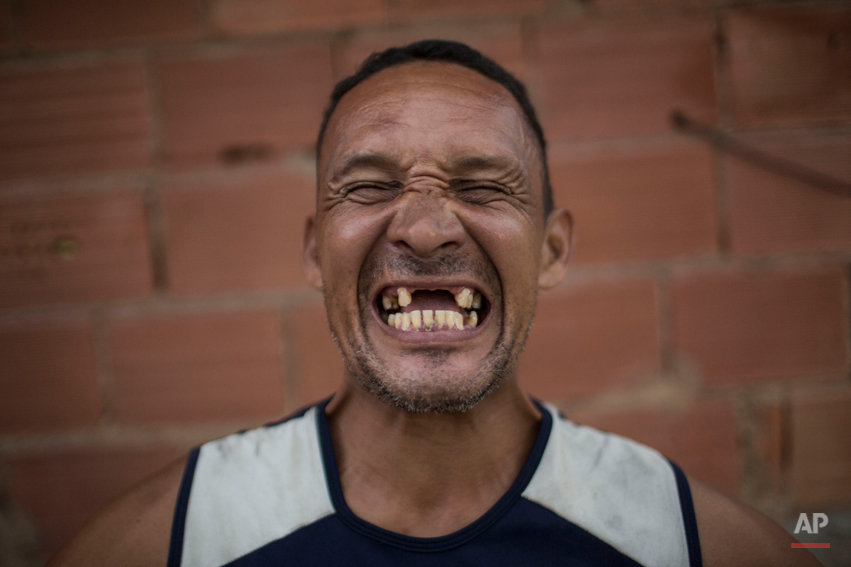  In this May 9, 2014 photo, former drug user Renato Souza, 44, smiles for the camera at the God's Love rehabilitation center in Rio de Janeiro, Brazil. (AP Photo/Felipe Dana) 