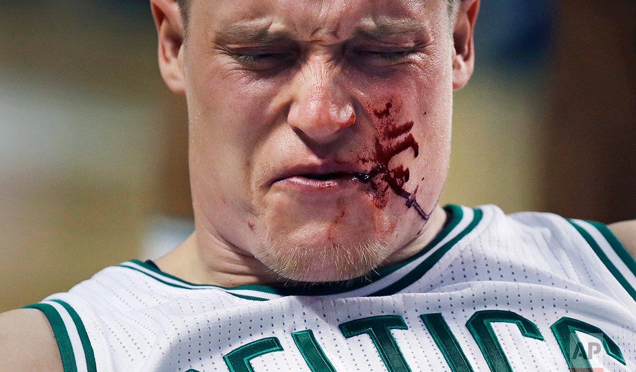  Boston Celtics forward Jonas Jerebko reacts after being hit by Houston Rockets guard James Harden during the fourth quarter of an NBA basketball game in Boston, Wednesday, Jan. 25, 2017. Harden was charged with a flagrant foul. The Celtics defeated 