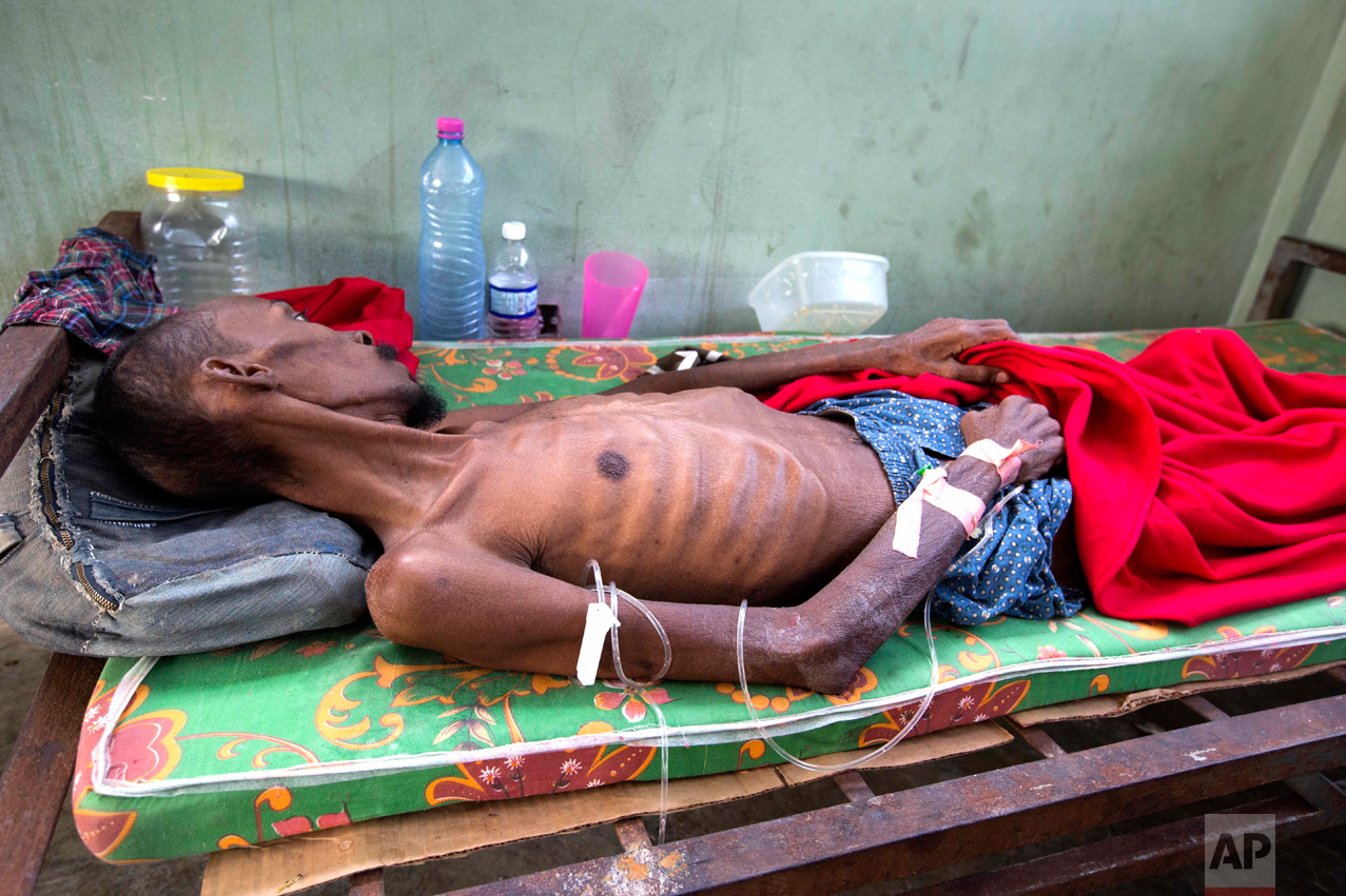 In this Feb. 13, 2017 photo, a prisoner, too weak to stand, lies in the prison infirmary at the National Penitentiary in downtown Port-au-Prince, Haiti. Haitian prosecutors and rights activists are sounding an alarm about collapsing conditions at the impoverished country's prisons as malnutrition from acute food shortages and a slew of preventable illnesses are leading to an upsurge of inmate deaths. (AP Photo/Dieu Nalio Chery)