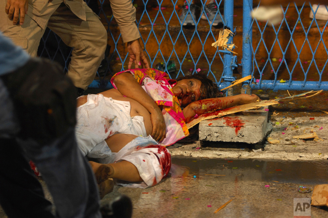  EDS NOTE: GRAPHIC CONTENT - An injured woman is helped after a float of the first samba school crash during Carnival celebrations at the Sambadrome in Rio de Janeiro, Brazil, Sunday, Feb. 26, 2017. A float in Rio de Janeiro's world famous Carnival p