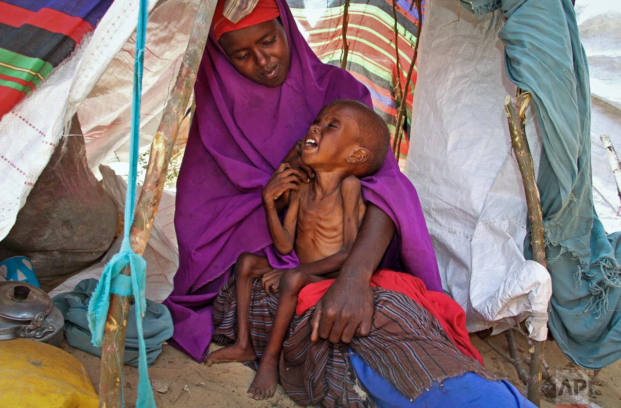 Recently displaced mother Sahra Muse, 32, comforts her malnourished child, Ibrahim Ali, 7, in their makeshift shelter at a camp in the Garasbaley area on the outskirts of Mogadishu, Somalia on Tuesday, March 28, 2017. Drought-stricken families facing a hunger crisis are on the move, trying to reach international aid agencies that are unable to distribute food in areas under the control of al-Shabab, Somalia's homegrown Islamic extremist rebels affiliated with al-Qaida. (AP Photo/Farah Abdi Warsameh)