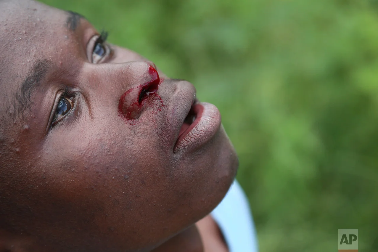In this Feb. 12, 2017 photo, a young boy nose bleeds after taking a few punches in a boxing ring in Chitungwiza, ZImbabwe. (AP Photo/Tsvangirayi Mukwazhi)
