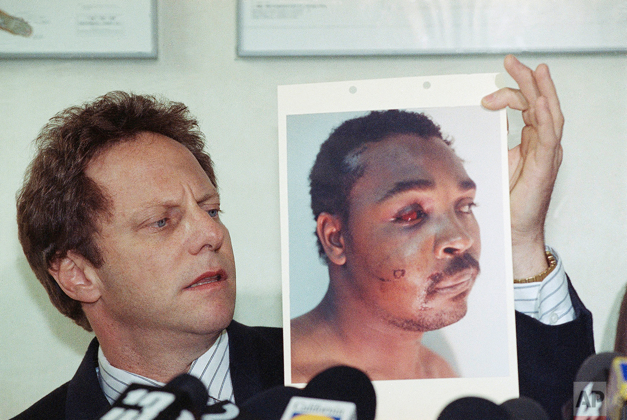 Steven Lerman, attorney for Rodney King, displays a photo of his client during a press conference at his office in Beverly Hills, California, Friday, March 8, 1991. King's doctor outlined the extent of man's injuries for reporters during the meeting. (AP Photo/Nick Ut)