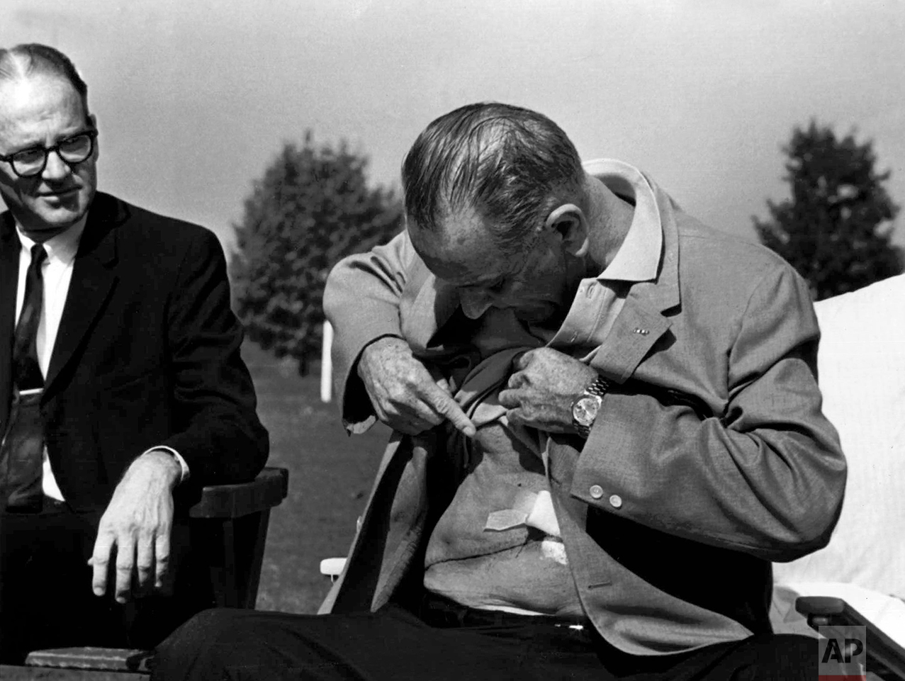  U.S. President Lyndon Baines Johnson displays the incision from his gall bladder surgery and kidney stone removal at a news conference at Bethesda Naval Hospital in Washington Oct. 20, 1965. (AP Photo/Charles Tasnadi) 