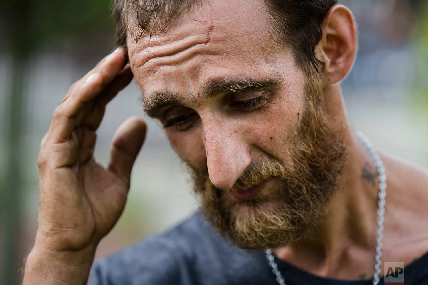  In this Monday, July 24, 2017 photo, Steven Kemp, who is addicted to heroin and is homeless, speaks with The Associated Press after meeting with a Philly Restart representative for help to obtain an identification card in Philadelphia. (AP Photo/Mat