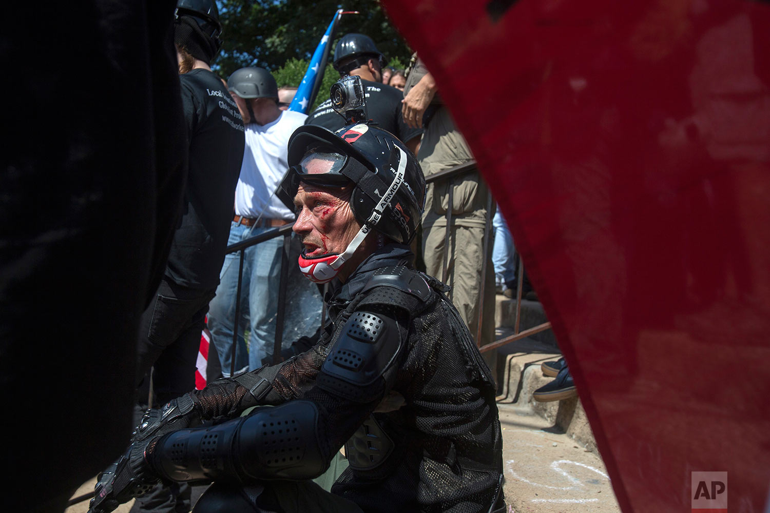  An injured man sits on the ground during a white nationalist rally on Saturday Aug. 12, 2017, in Charlottesville, Va. The group had gathered to protest plans by the city of Charlottesville to remove a statue of Confederate Gen. Robert E. Lee. (Shaba