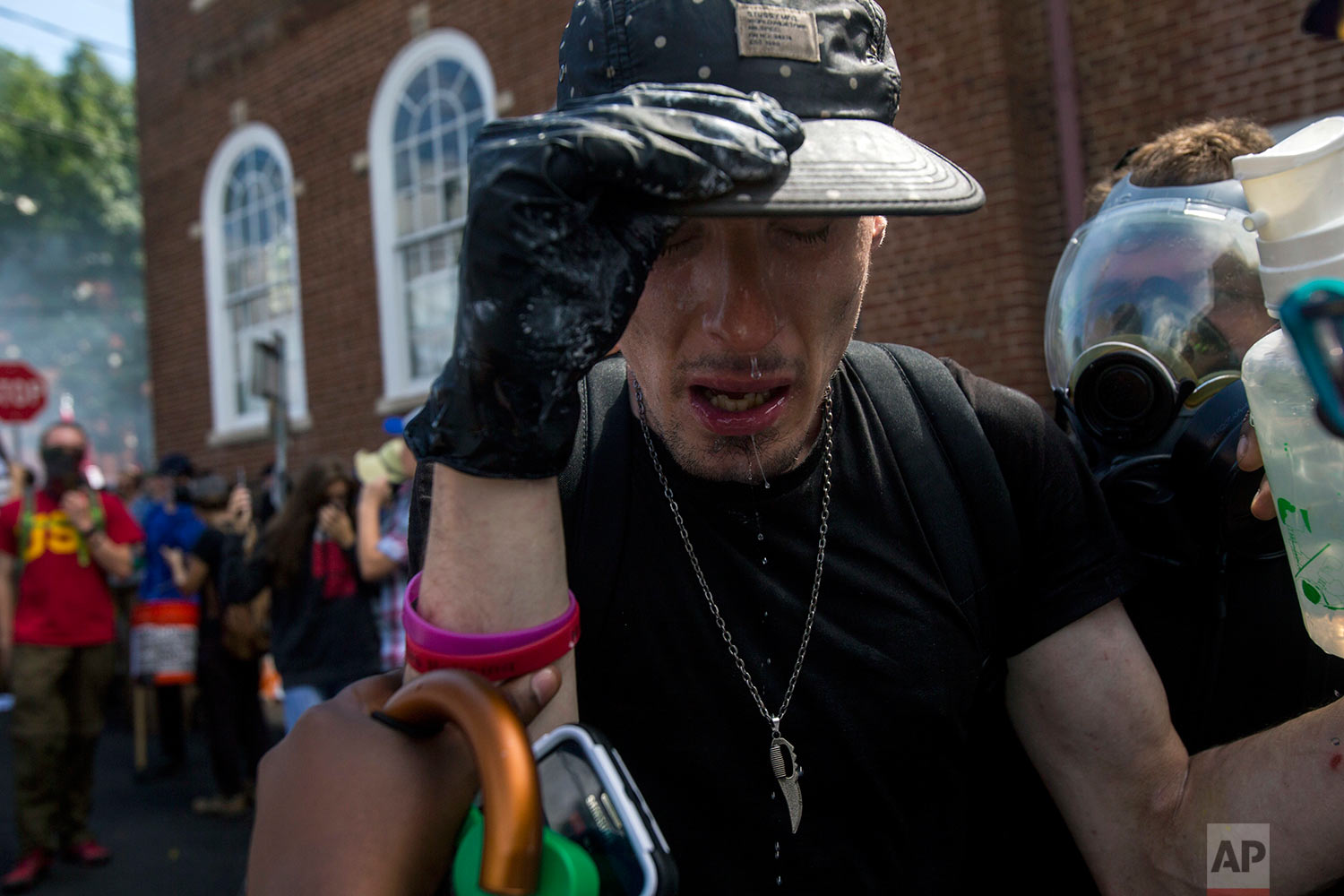  A counter-protester reacts after getting an eye wash after being sprayed with a substance during a white nationalist rally on Saturday Aug. 12, 2017, in Charlottesville, Va. (Shaban Athuman /Richmond Times-Dispatch via AP) 