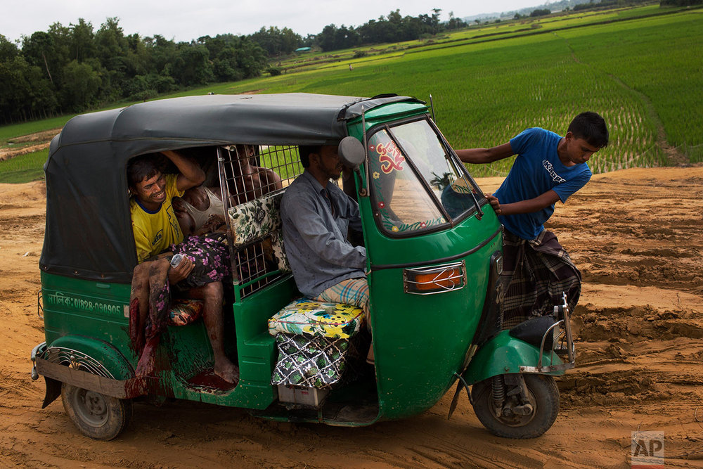  EDS NOTE GRAPHIC CONTENT: An injured elderly woman and her relatives rush to a hospital on an autorickshaw, near the border town of Kutupalong, Bangladesh, Monday, Sept. 4, 2017. The Rohingya woman encountered a landmine that blew off the right leg 