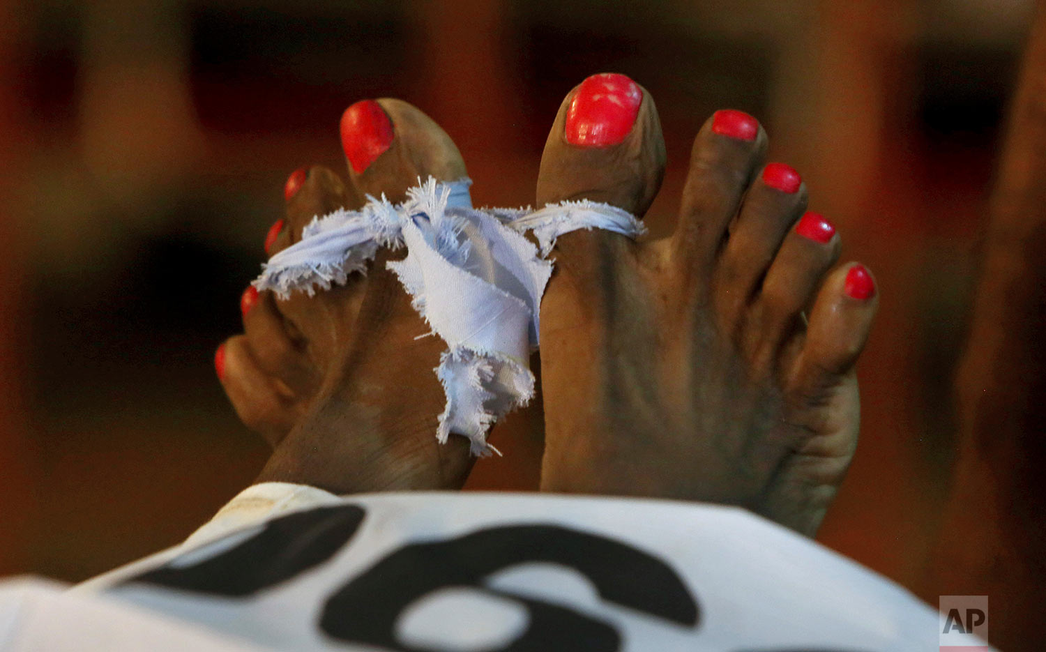  The feet of a transgender person, who was killed by unknown gunmen, are knotted together at a morgue in Karachi, Pakistan, Wednesday, Aug. 30, 2017. Pakistani police say gunmen opened fire on a group of transgender people, killing one of them, in an