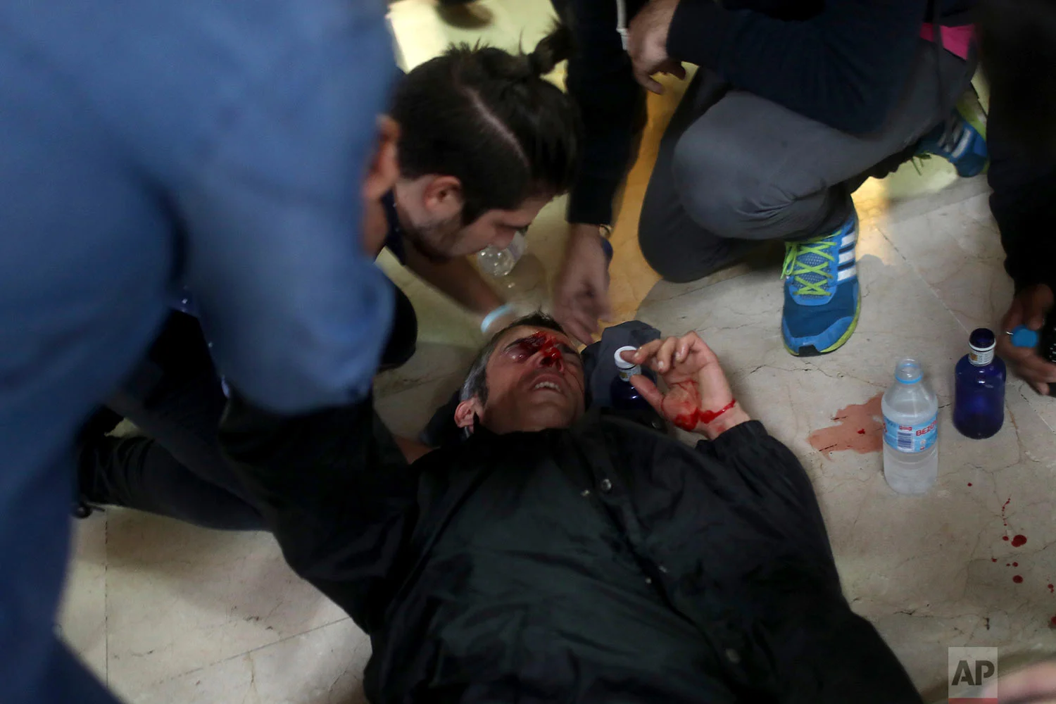 A protester is attended after being hit by a rubber bullet shot by Spanish National Police near the Ramon Llull school assigned to be a polling station by the Catalan government in Barcelona, Spain, early Sunday, 1 Oct. 2017. (AP Photo/Manu Brabo)