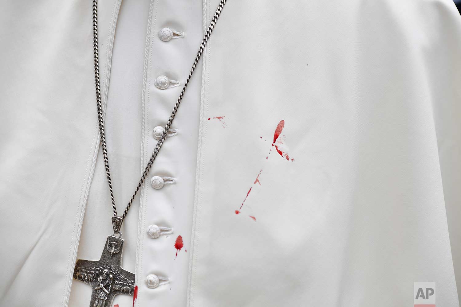 A drop of blood stains Pope Francis' white cassock after he knocked his head on the popemobile in Cartagena, Colombia, Sunday, Sept. 10, 2017. (Alberto Pizzoli/Pool via AP)