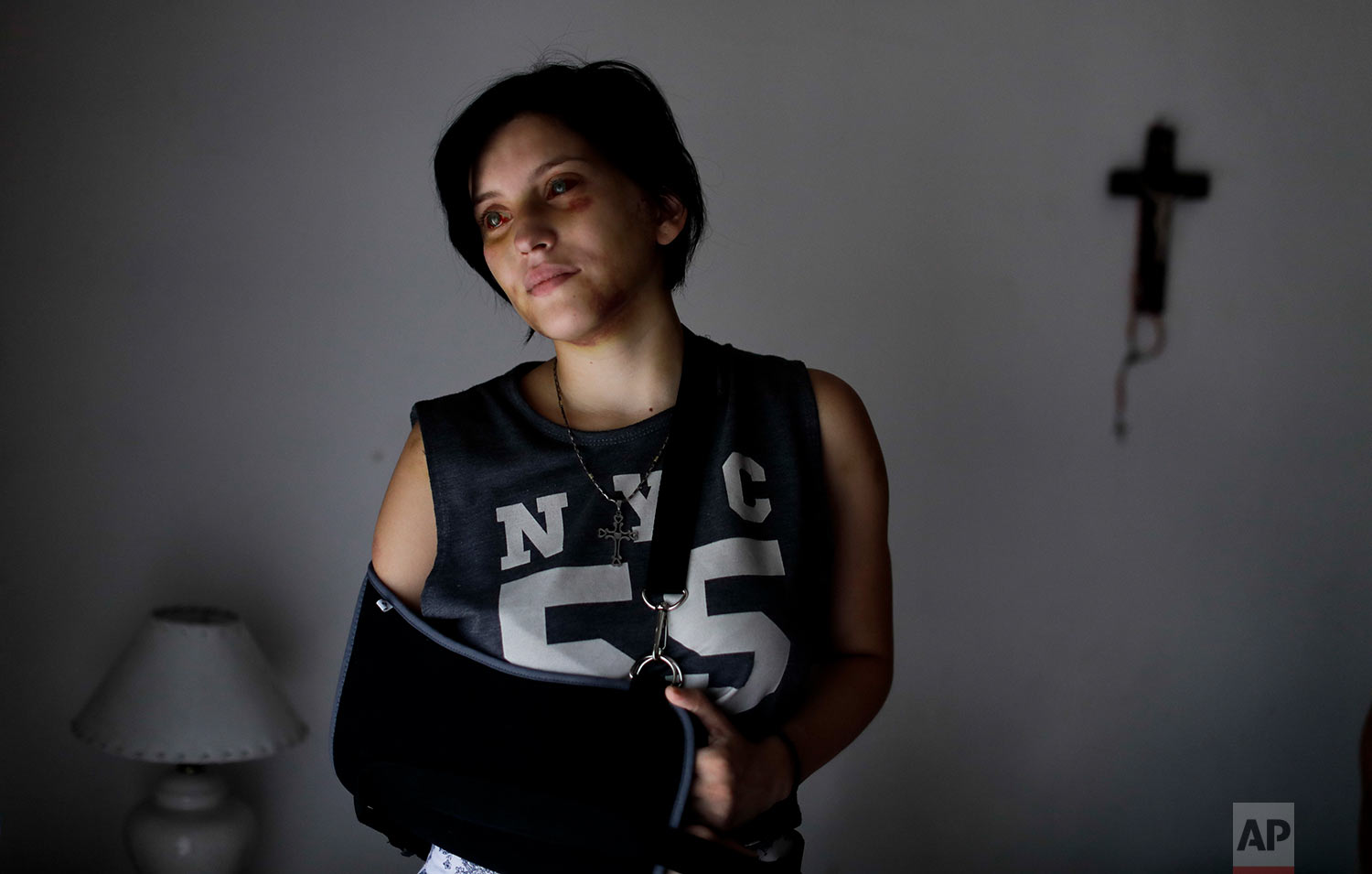 Belen Torres poses for a portrait in Buenos Aires, Argentina, Wednesday, Feb. 8, 2017. Torres was beaten by her boss, just a few days after starting her first job in the capital doing administrative paperwork for an anesthesiologist, to help her family pay the bills. The doctor asked her to get high and tried to have sex with her. After he beat her, she was able to escape and run outside, where an unknown man called 911. (AP Photo/Natacha Pisarenko)