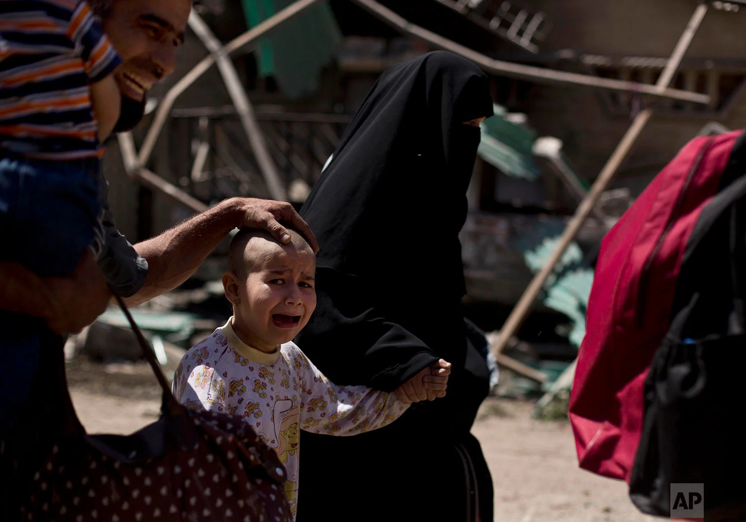 A girl with a shaved head and her father cry as the family flees the al-Rifai neighborhood while Iraqi special forces battle Islamic State militants in western Mosul, Iraq, Wednesday, May 17, 2017.(AP Photo/Maya Alleruzzo)