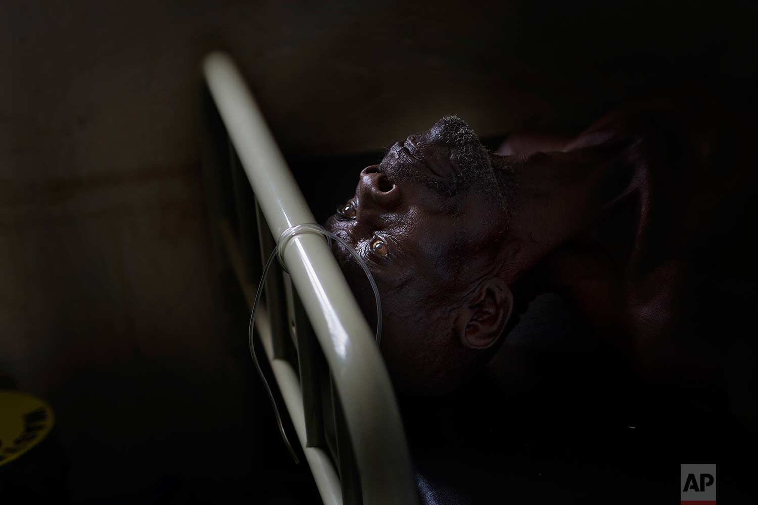  In this Monday, April 3, 2017 photo, Alfred Wani lays on a bed in the clinic at the Imvepi refugee settlement in northern Uganda. Alfred fell ill during the night and had to have blood drawn. (AP Photo/Jerome Delay) 
