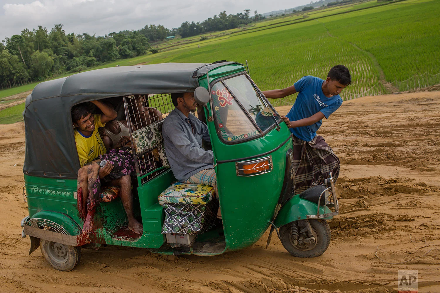 An injured Rohingya Muslim woman and her relatives rush to a hospital on an autorickshaw, near Kutupalong, Bangladesh, on Sept. 4, 2017. While crossing into Bangladesh, the elderly woman stepped on a land mind that blew off her right leg, witnesses said. Myanmar’s military has been accused of planting land mines in the path of Rohingya Muslims fleeing violence in its western Rakhine state. (AP Photo/Bernat Armangue)