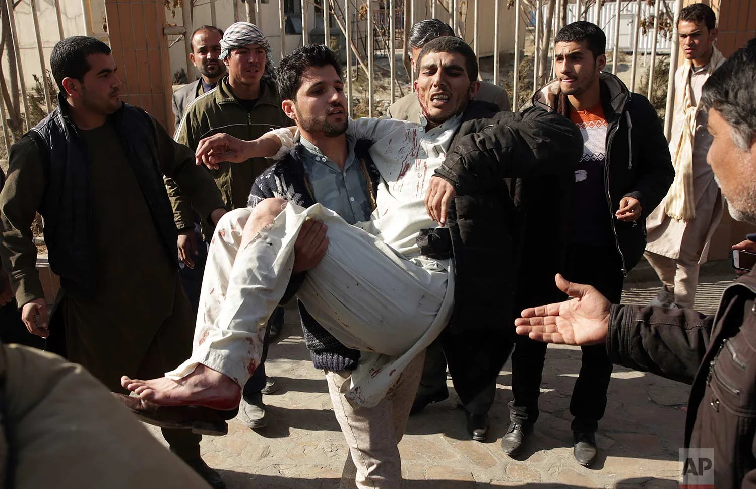 A wounded man is assisted at the site of a deadly suicide attack in the center of Kabul, Afghanistan, Saturday, Jan. 27, 2018. (AP Photo/Massoud Hossaini)