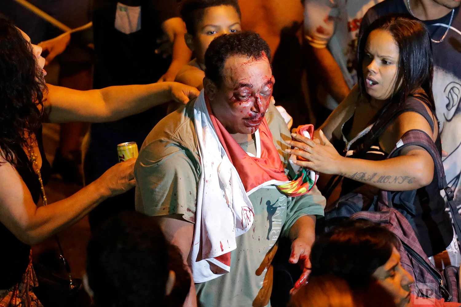 Supporters of Brazil's former President Luiz Inacio Lula da Silva try to help a man who was involved in a brawl outside the metal workers union headquarters where da Silva is hunkered down and his supporters have gathered, in Sao Bernardo do Campo, Brazil, Friday, April 6, 2018. Da Silva defied a 5 p.m. deadline to turn himself into police in the city of Curitiba so he can begin to serve a 12-year sentence on a corruption conviction. (AP Photo/Nelson Antoine)