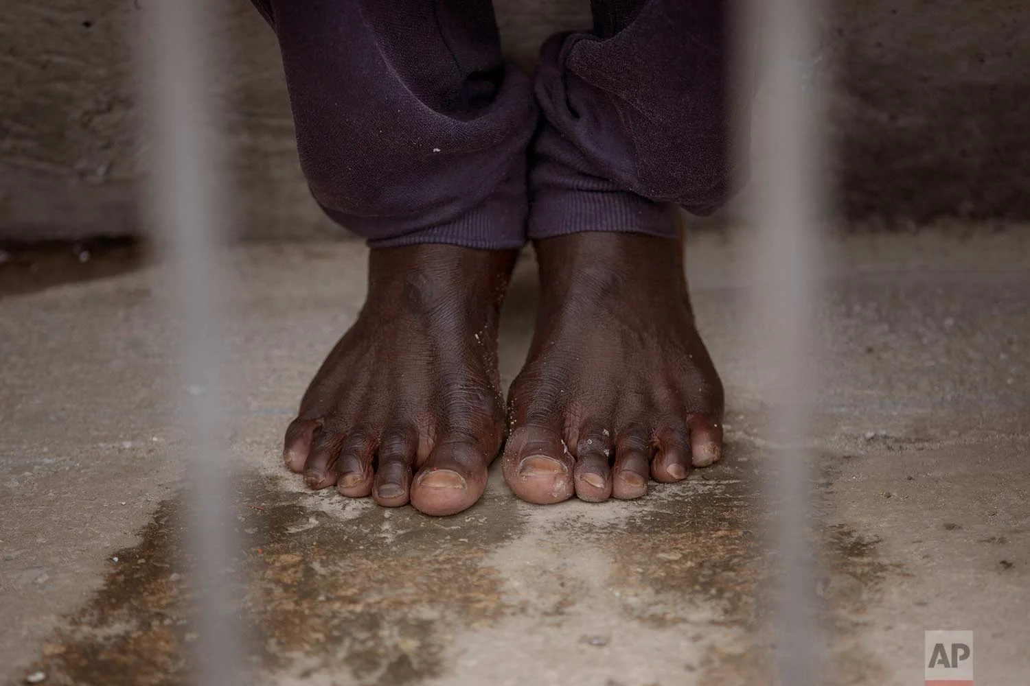 In this Wednesday, June 27, 2018 photo, a migrant rests at the port of Tarifa, southern Spain, as he waits to be transported to a police station after being rescued by Spain's Maritime Rescue Service in the Strait of Gibraltar. The route from northern Africa into Spain has become the most popular for those seeking a better life in Europe, testing Spain’s response networks as the migration debate re-emerges in the region. (AP Photo/Emilio Morenatti)