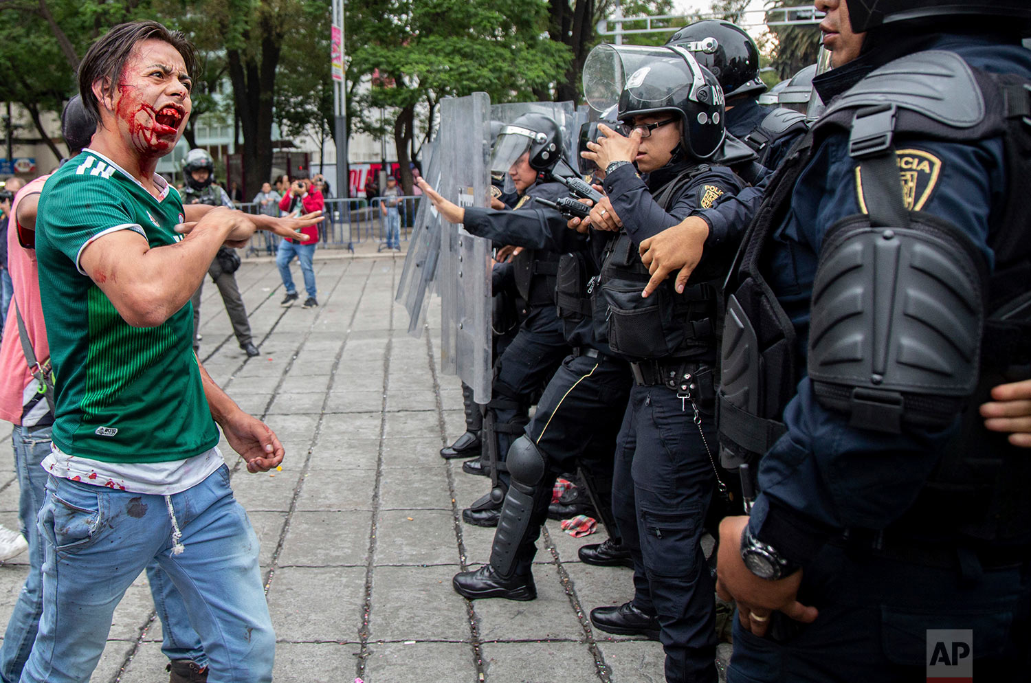  A bloodied soccer fan talks back to officers after being injured by the police during a scuffle, after Mexico soccer fans celebrated their World Cup game win in Mexico City, June 17, 2018. (AP Photo/Anthony Vazquez) 