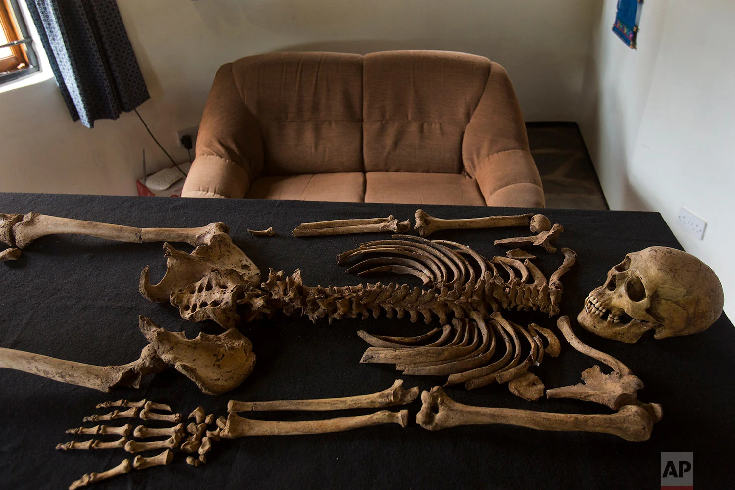 The remains of Julius Mvulo Nyathi lay on a table at the Solidarity Peace Trust offices in Bulawayo, Zimbabwe. (AP Photo/Jerome Delay)