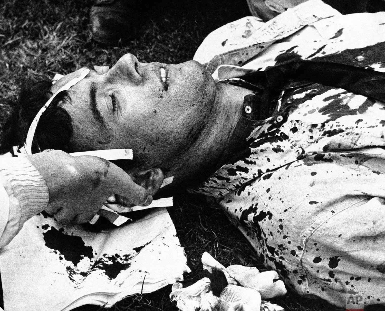 An unidentified man receives first aid in Chicago's Grant Park during a confrontation between police and antiwar demonstrators, August 28, 1968. (AP Photo)