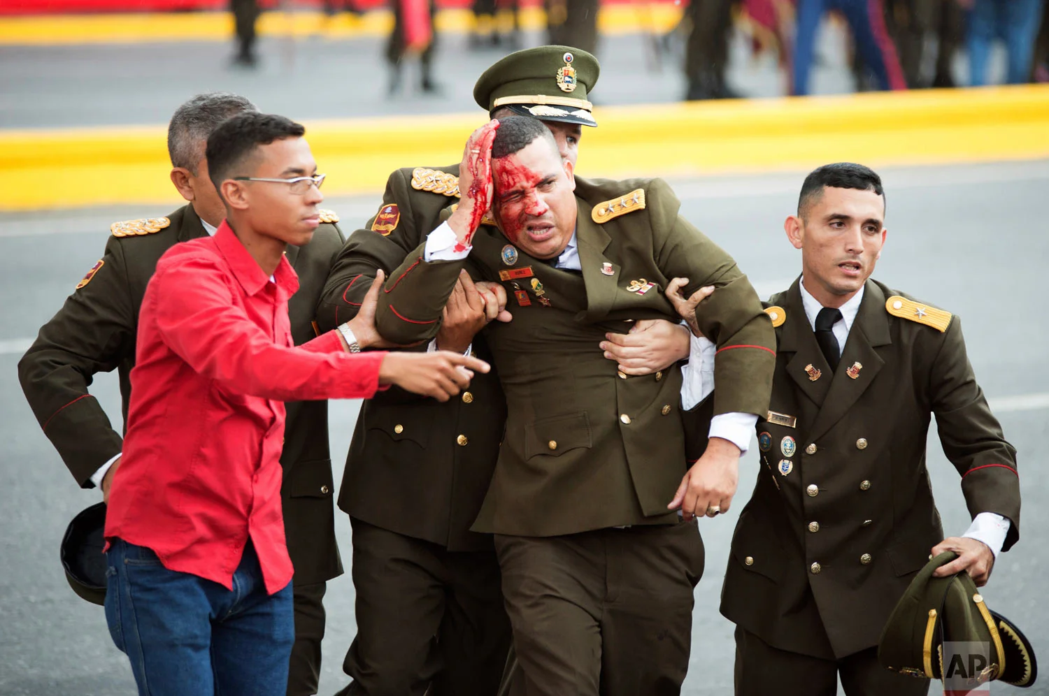 An uniformed official bleeds from the head following an incident during a speech by Venezuela's President Nicolas Maduro in Caracas, Venezuela, Saturday, Aug. 4, 2018. Seven people were injured in the apparent attack which came as Maduro celebrated the National Guard's 81st anniversary. Maduro's speech was abruptly cut short and soldiers could be seen breaking ranks and scattering. (Xinhua via AP)