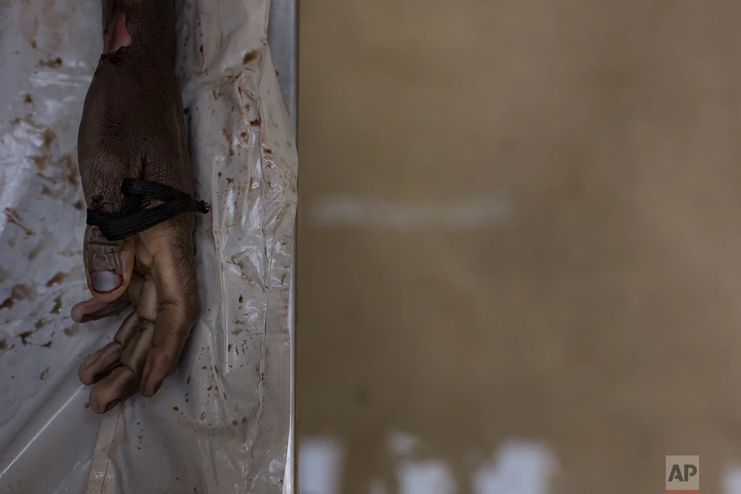 In this Monday, April 16, 2018 photo, the hand of an unidentified male is seen at a mortuary in Johannesburg during forensic examination. (AP Photo/Bram Janssen)