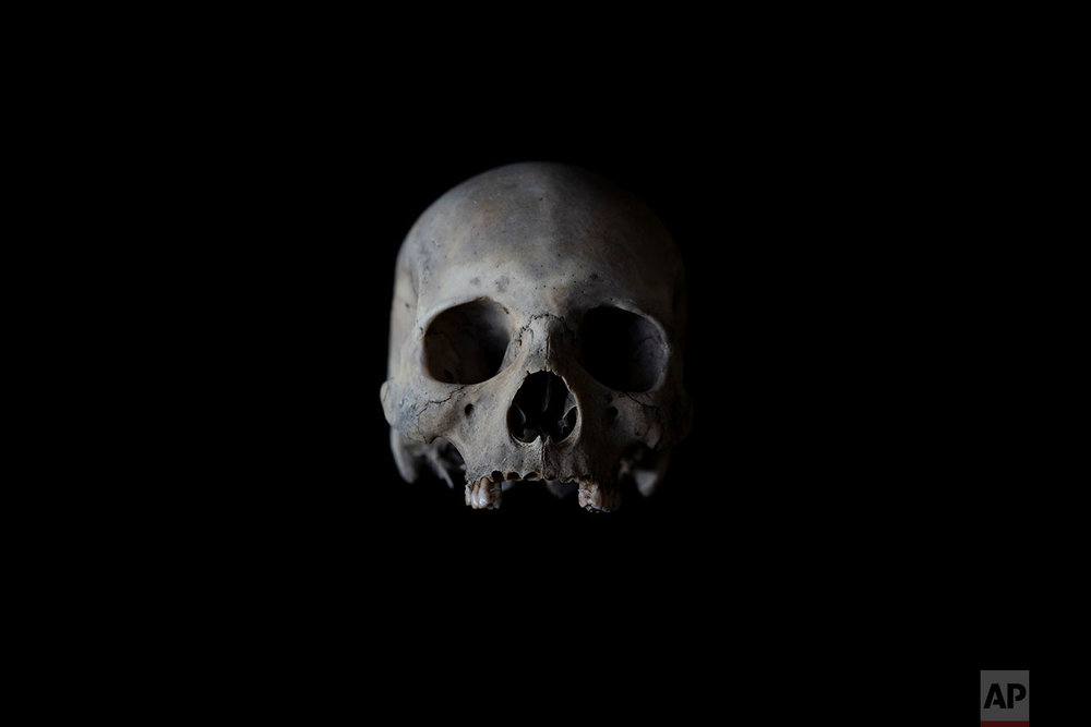  In this Monday Oct. 1, 2018 photo, the skull of a black unidentified adult male is seen. The remains were found in August 2018 in a field in Johannesburg and brought to a mortuary for identification purposes. Once a demographic profile is estimated 