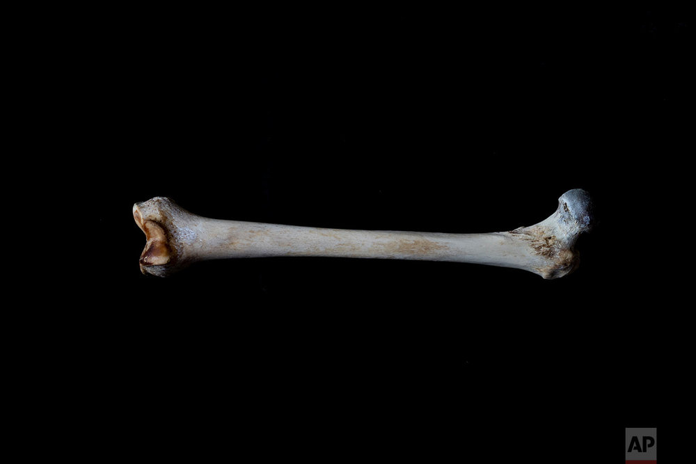  In this Monday Oct. 1, 2018 photo, the thigh bone of a black unidentified adult male is seen. The remains were found in August 2018 in a field in Johannesburg and brought to a mortuary for identification purposes. Once a demographic profile is estim