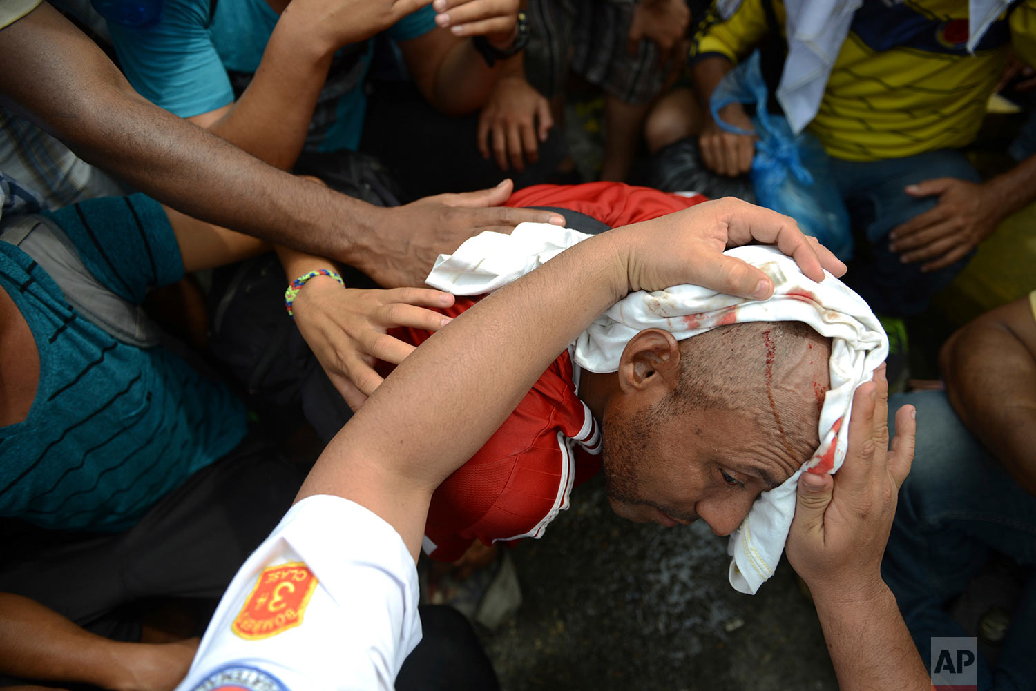  Migrants rush to the aide of a man injured by a rock thrown by an unidentified person at the border bridge in Tecun Uman, Guatemala, Friday, Oct. 19, 2018, as migrants broke down the gates at the Guatemala-Mexico border crossing. (AP Photo/Oliver de