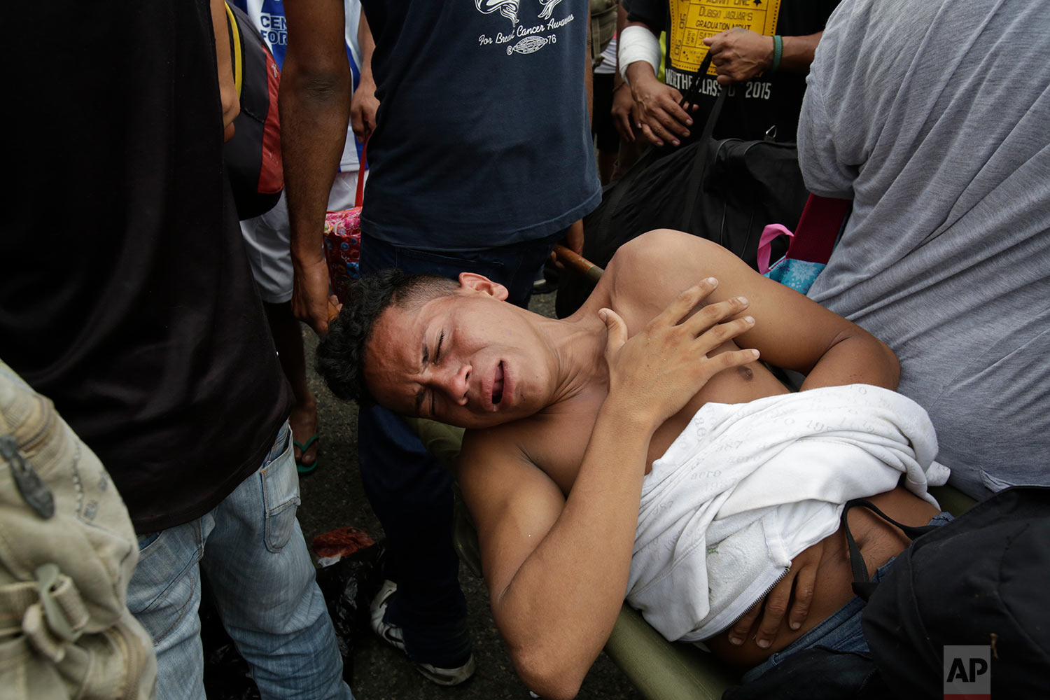  A wounded man grimaces in pain after clashes with the Mexican Federal Police at the border crossing in Ciudad Hidalgo, Mexico, Friday, Oct. 19, 2018. (AP Photo/Moises Castillo) 