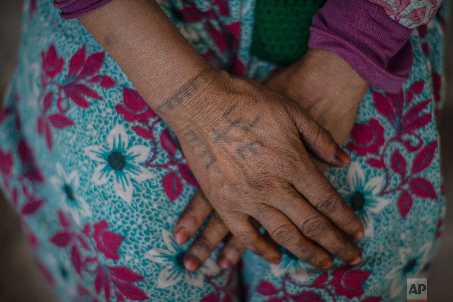 In this Saturday, Oct. 13, 2018 photo, Marhich Rkia Ali, 48, displays tattoos on her arm as she poses for a portrait, in the town of Anregui, near Azilal, central Morocco. (AP Photo/Mosa'ab Elshamy)