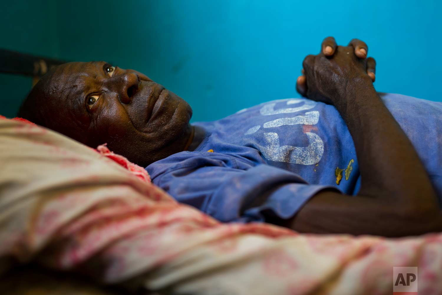  Gabriel Mutamba lies on his hospital bed at the Katuba Reference Hospital in Lubumbashi, Democratic Republic of the Congo on Monday, Aug. 13, 2018. Mutamba, in his 80s, was first brought to the hospital in 2017 by a church group that found him with 