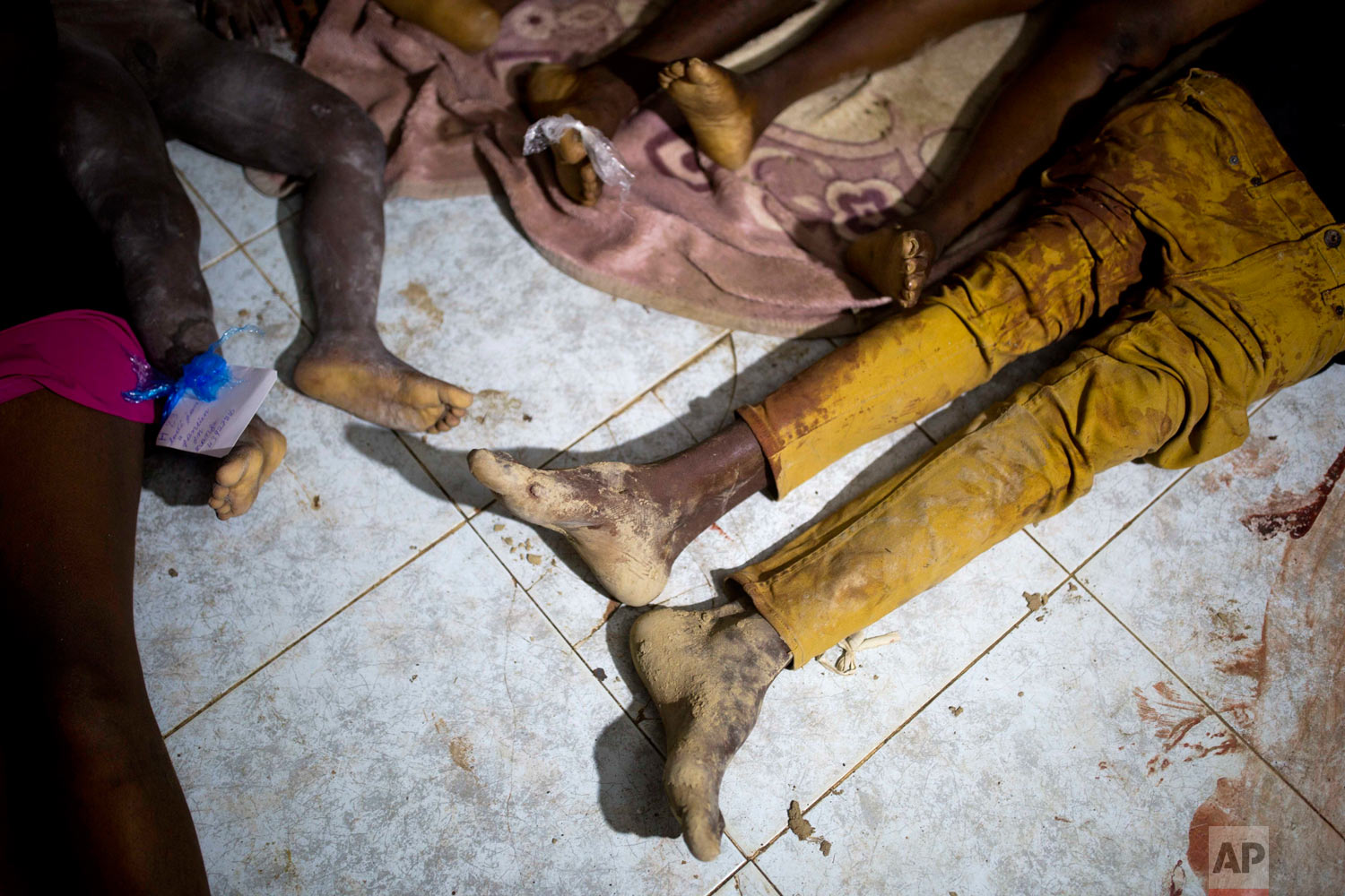  Bodies lie in the morgue of the general hospital after a 5.9 magnitude earthquake hit Port-de-Paix, Haiti, Oct. 7, 2018. The death toll rose to 17 people with hundreds injured, authorities said. (AP Photo/Dieu Nalio Chery) 