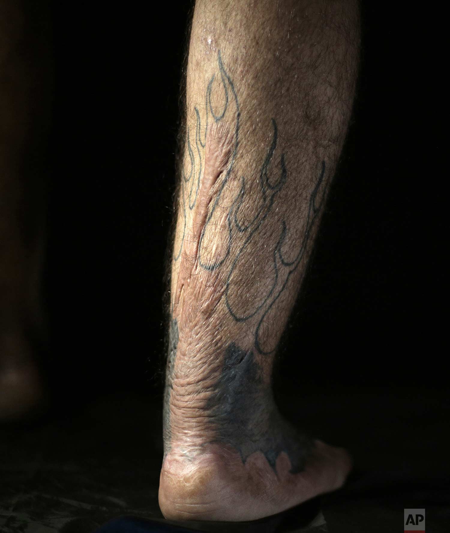  In this Wednesday. Oct. 24, 2018, photo, Iraqi soldier Saad Khudeir displays a tattoo on his leg to cover scars of the burns he suffered in a car bombing, in Baghdad, Iraq. “I don’t want just to cover my wounds, but also to tell the story behind my 