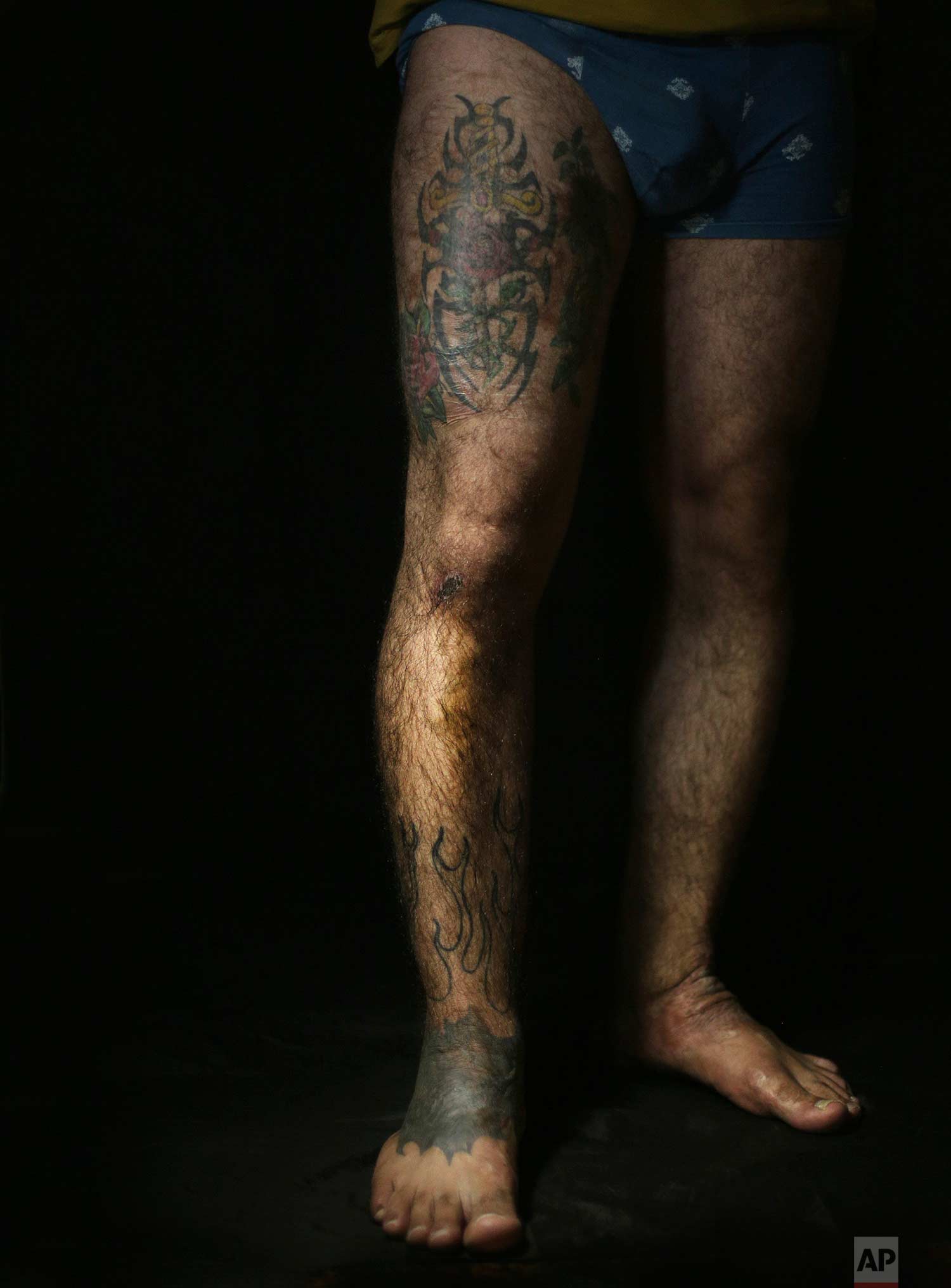  In this Wednesday. Oct. 24, 2018, photo, Iraqi soldier Saad Khudeir displays tattoos on his leg to cover scars of the burns he suffered in a car bombing, in Baghdad, Iraq. “People stared at me and sometime I felt they were scared of me at the swimmi