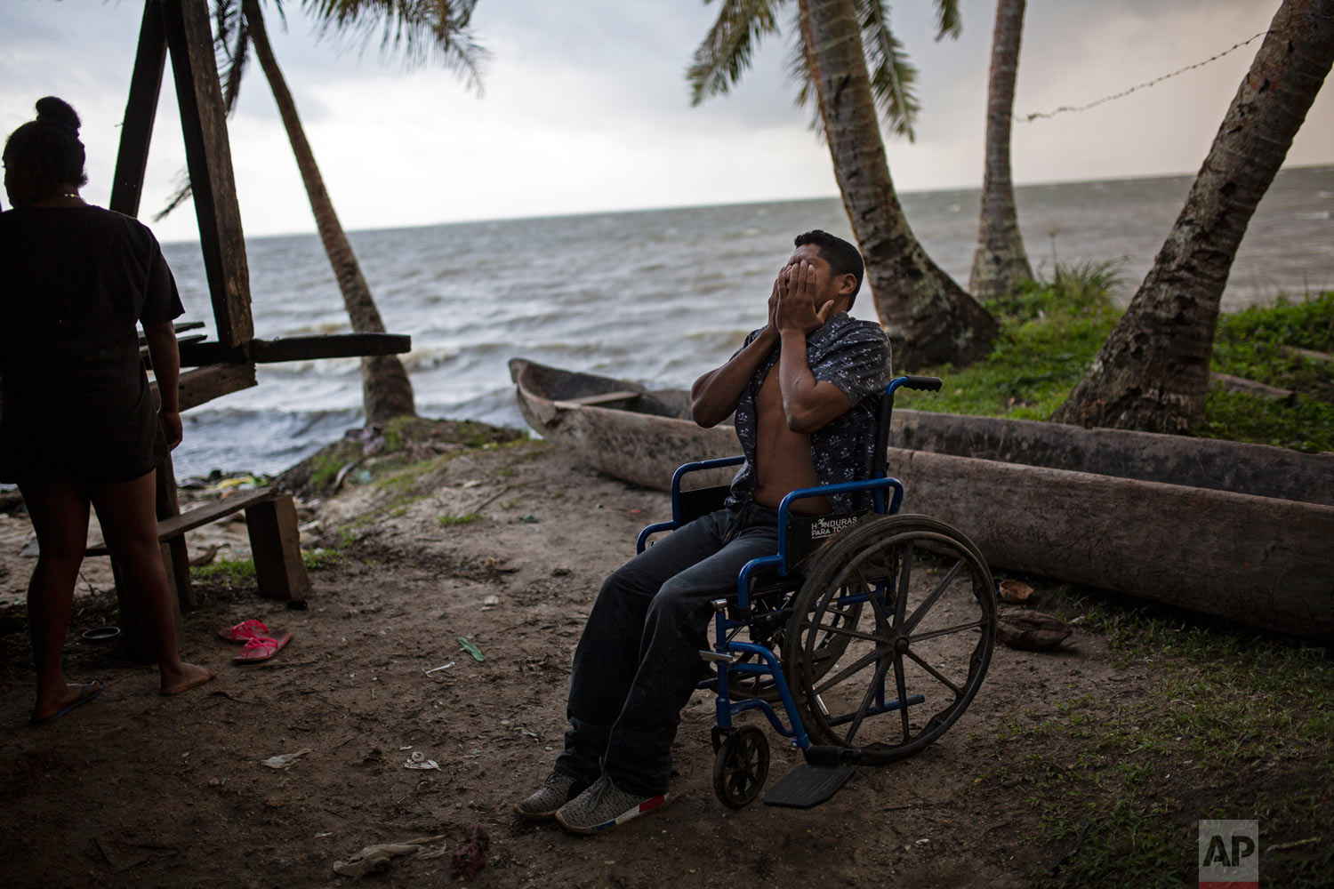  In this Jan 31, 2018 photo, 28-year-old lobster diver Charly Melendez puts his hands over his face in frustration as he comes to terms with having to rely on a wheelchair to get around, in Puerto Lempira, Honduras. (AP Photo/Rodrigo Abd) 