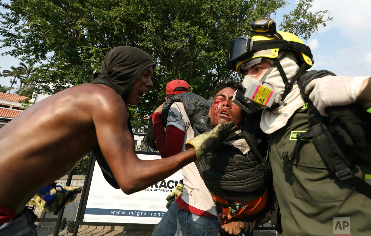 A Venezuelan youth, injured in clashes with Venezuelan National Guardsmen, is carried to a safe zone, at the Simon Bolivar International Bridge in La Parada, Colombia, Feb. 25, 2019. (AP Photo/Fernando Vergara) 
