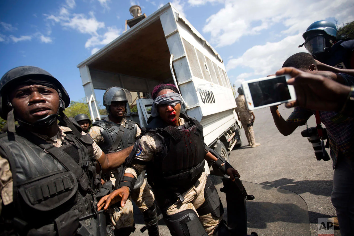  A national police officer is helped by fellow officers after she was injured in the face from a rock thrown by protesters demanding the resignation of Haitian President Jovenel Moise, near the presidential palace in Port-au-Prince, Haiti, Feb. 13, 2
