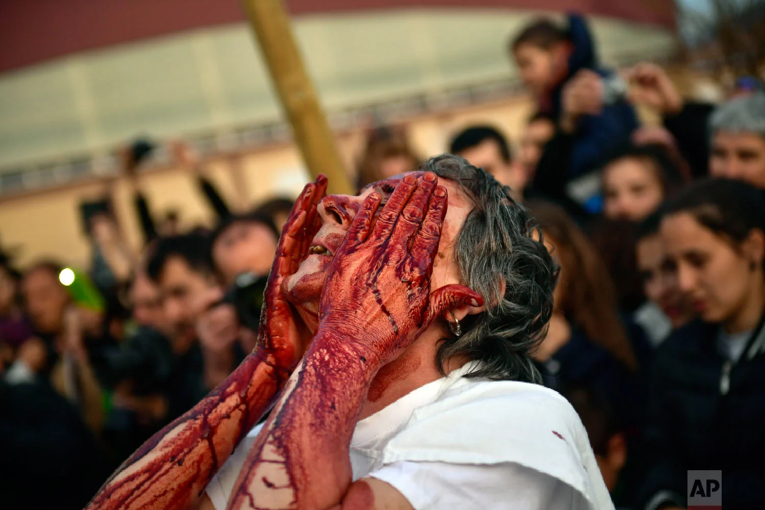 A "momotxorro'' covers his face with blood while taking part in the carnival wearing typical carnival dress, in Alsasua, northern Spain, Tuesday, March 5, 2019. (AP Photo/Alvaro Barrientos)