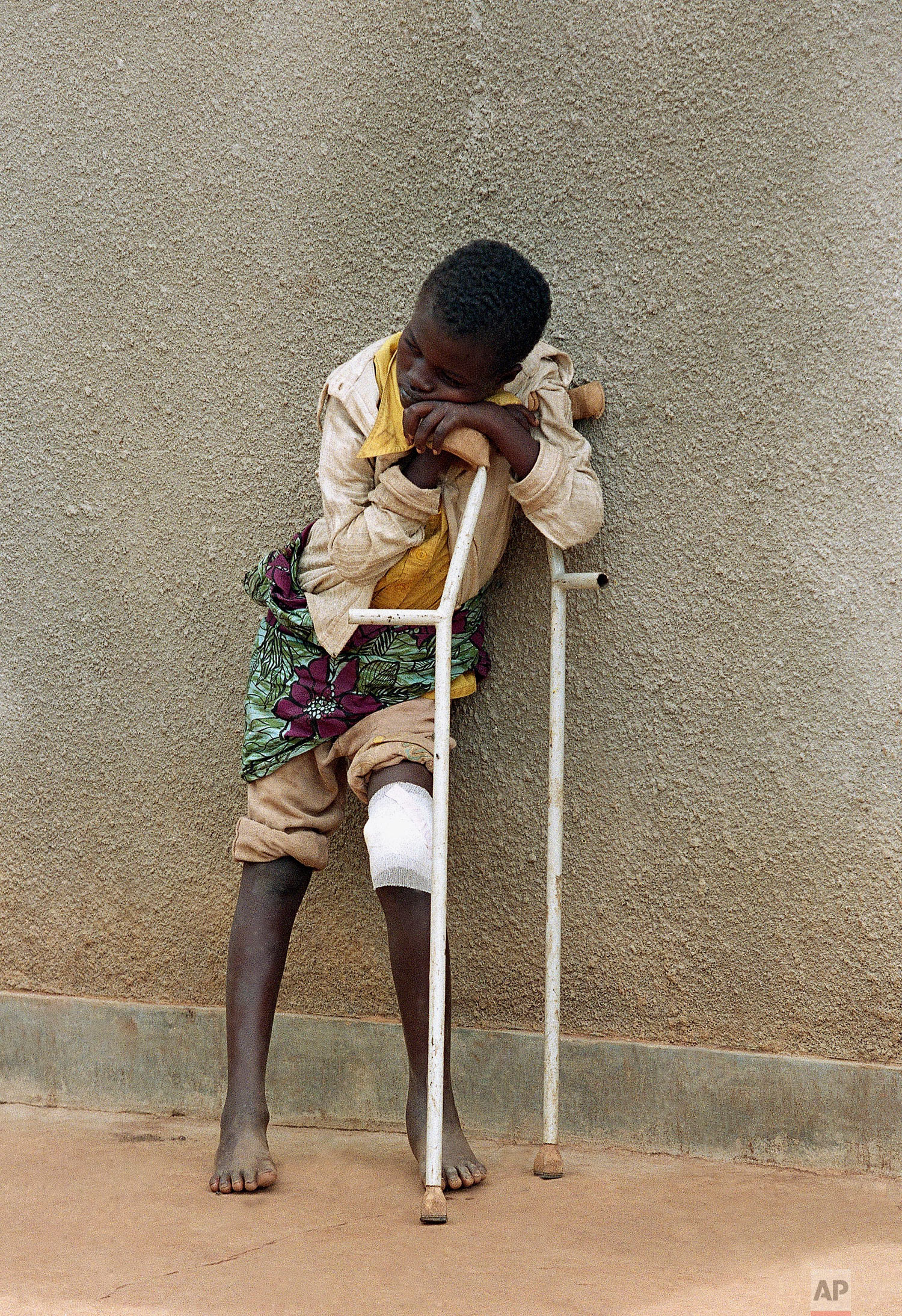 A boy, who survived a massacre in the village of Karubamba in April and whose leg was injured by a machete, rests at a hospital near Gahini, in Rwanda, May 13, 1994. (AP Photo/Jean-Marc Bouju)