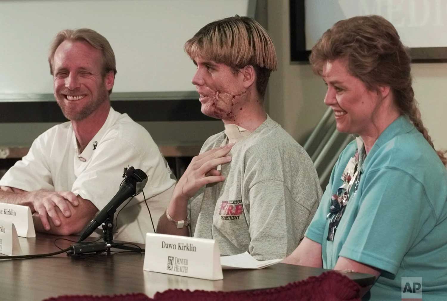  Lance Kirklin, center, shares a laugh with his parents, Mike, left, and Dawn during a news conference at Denver Health Medical Center on Friday, May 14, 1999. Kirklin, 16,  a Columbine High School sophomore, was shot five times during the shooting r