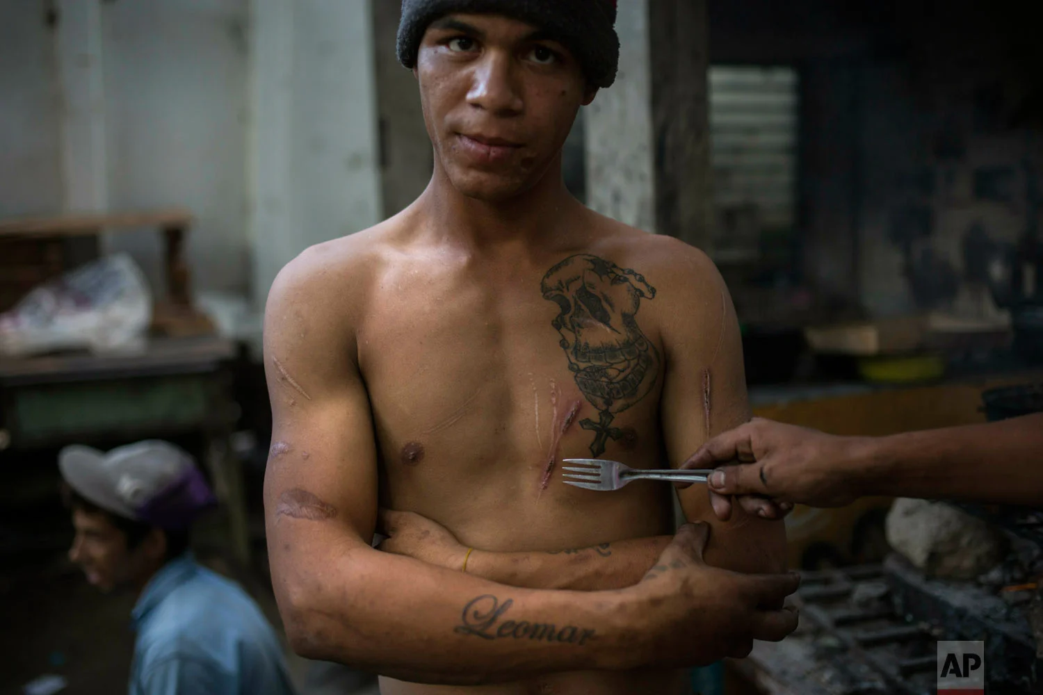Leomar Aguilar show the scars he got in prison as he gathers with friends outside a building occupied by squatting families in Caracas, Venezuela, Tuesday, May 7, 2019. Aguilar spent six years in prison after being convicted of robbery but went to live with the squatters after his release as he had nowhere else to go. (AP Photo/Rodrigo Abd)